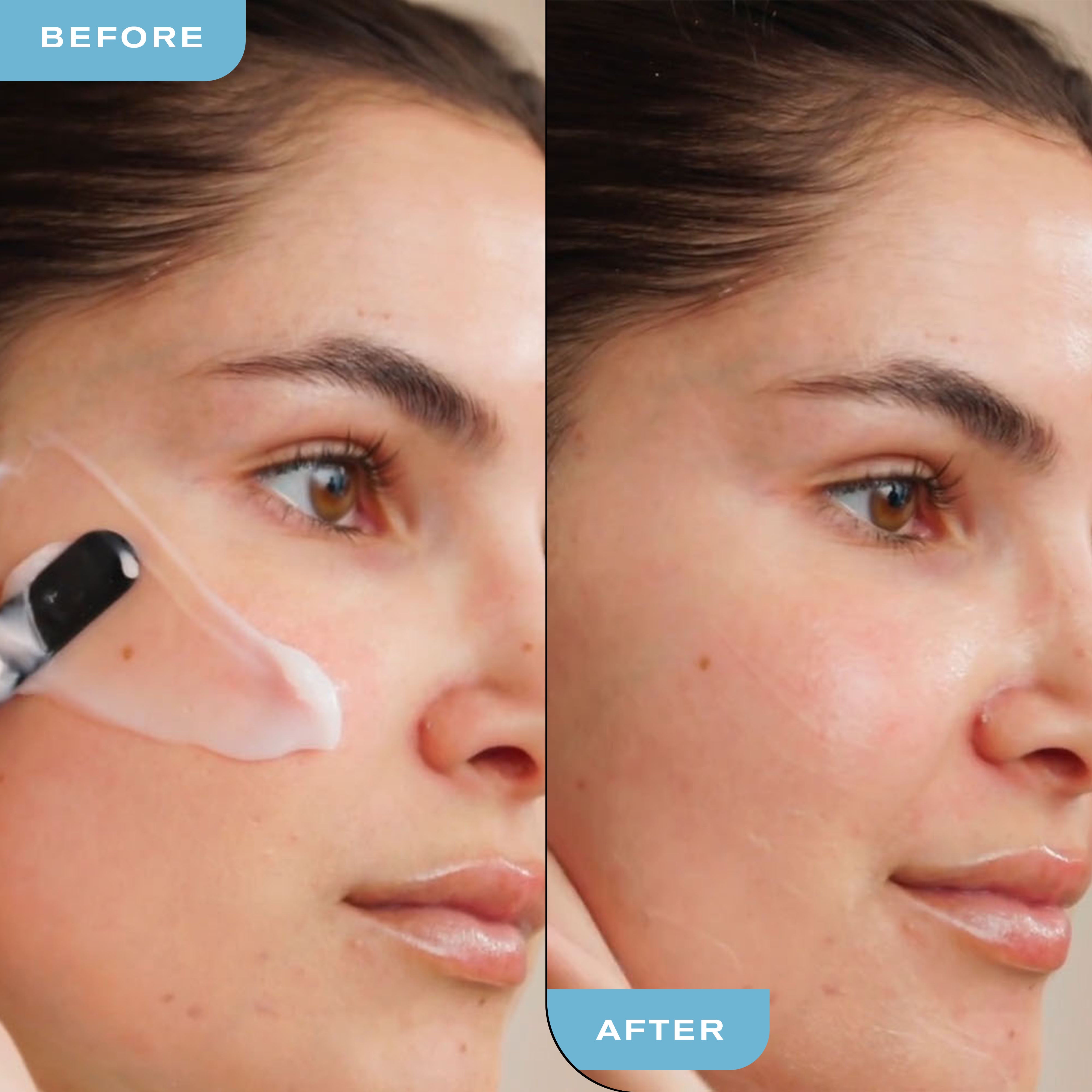 Before and After using Hydra-Therapy Memory Gel Sleep Mask