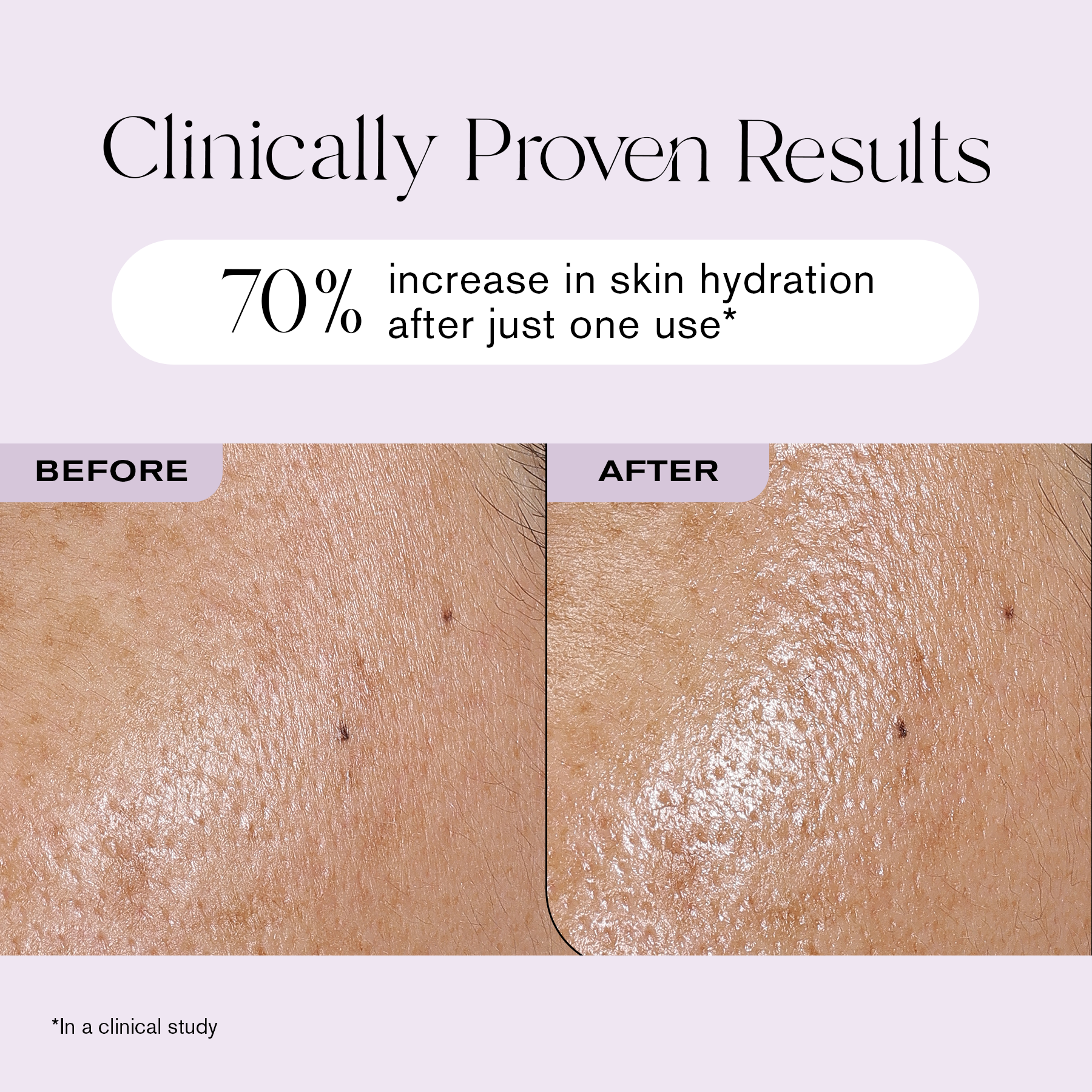 Clinically Proven Results
70% increase in skin hydration after just one use*
*In a clinical study.