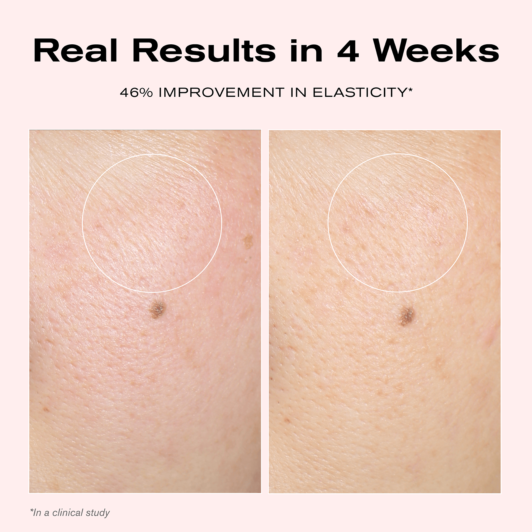 Real Results in 4 Weeks
46% Improvement in Elasticity*
*In a clinical study
