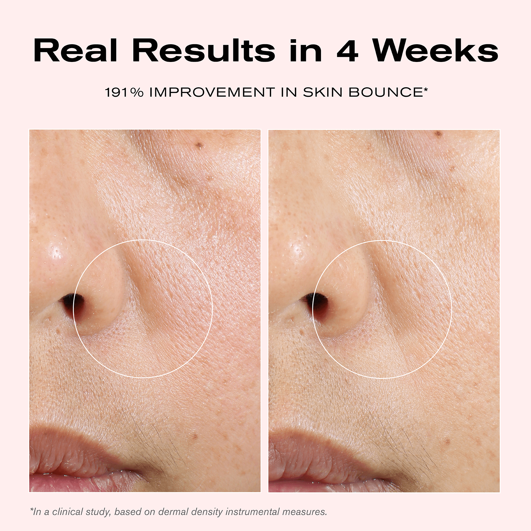 Real Results in 4 Weeks
191% Improvement in Skin Bounce*
*In a clinical study, based on dermal density instrumental measures.