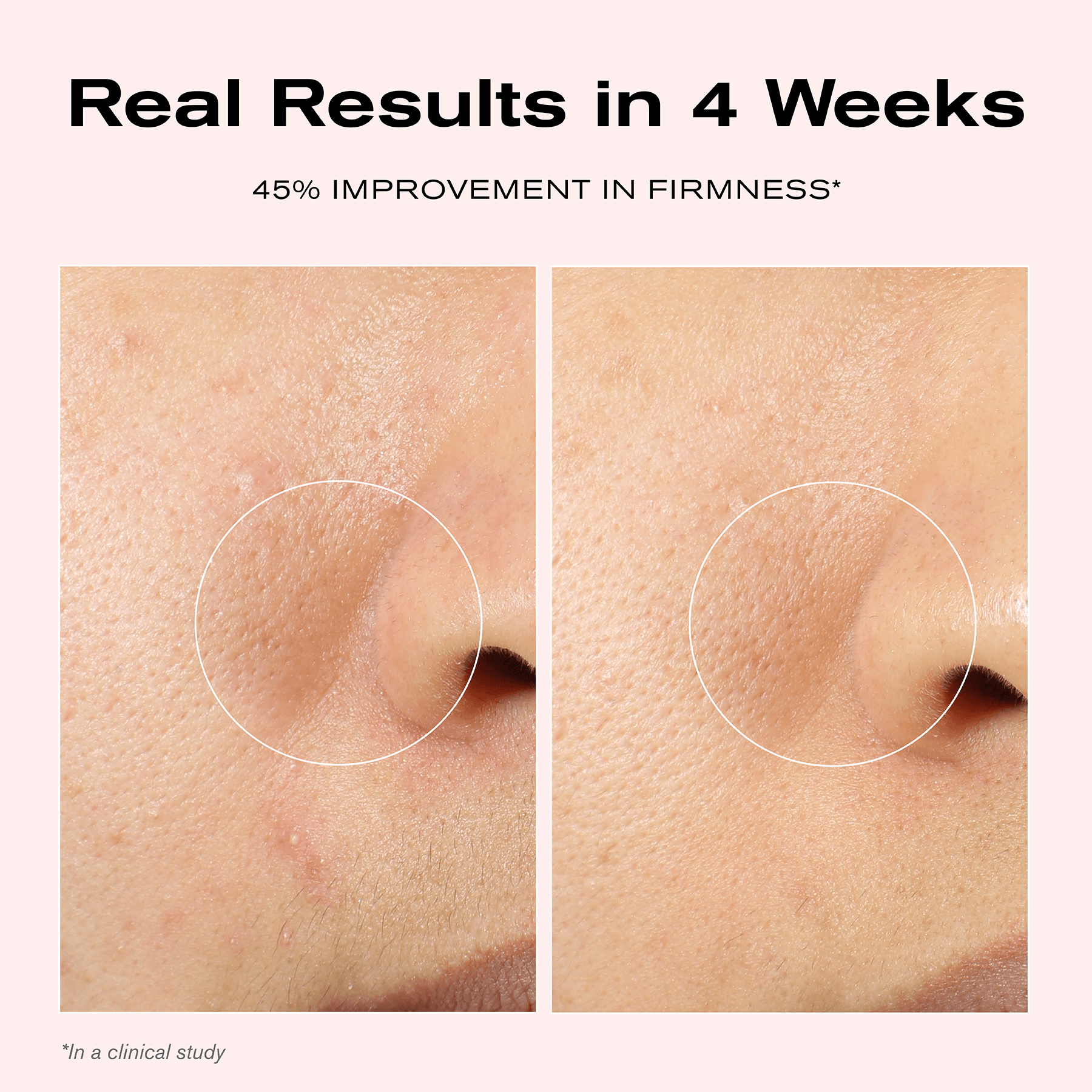 Real Results in 4 Weeks
45% Improvement in Firmness*
*In a clinical study