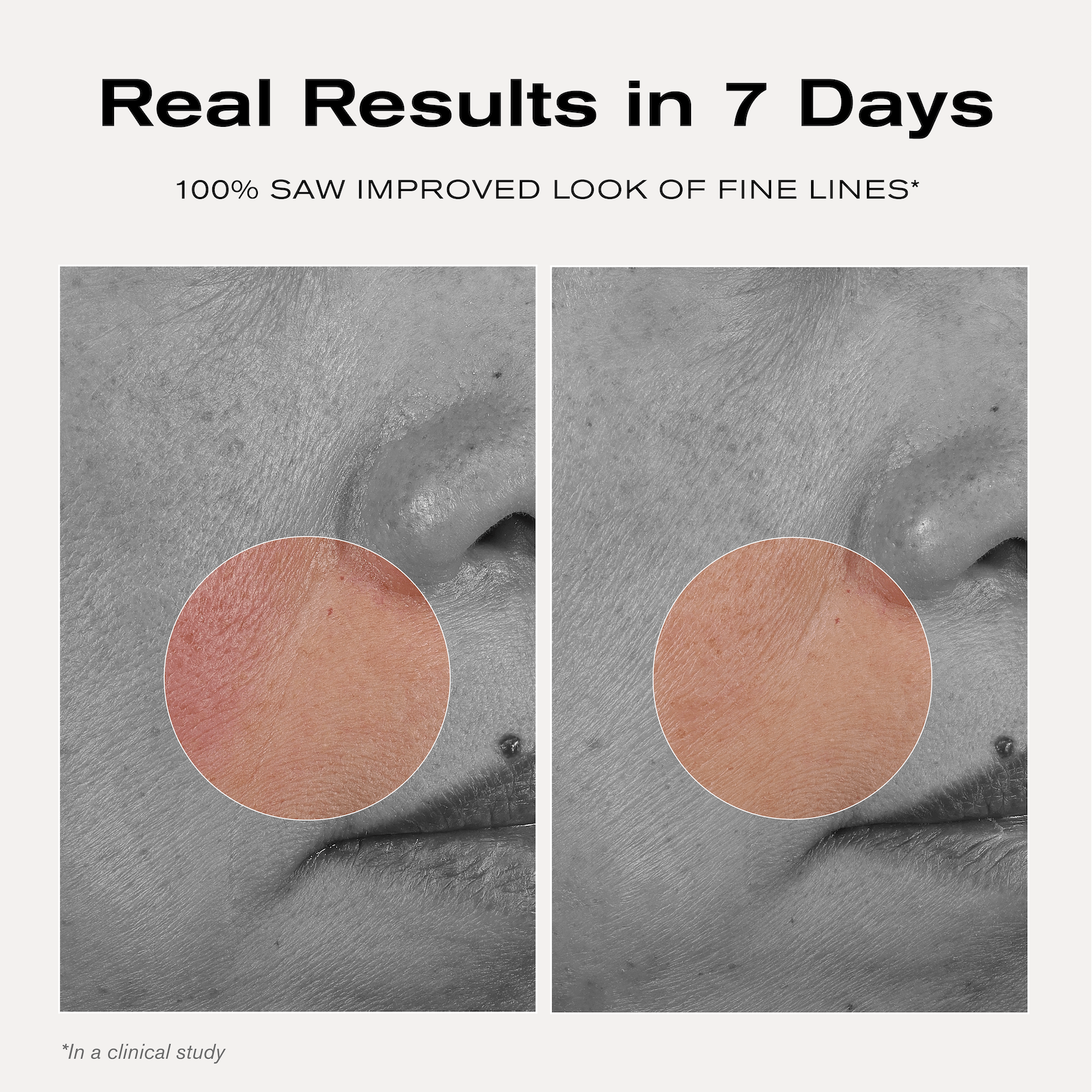 Real Results in 7 Days
100% saw improved look of fine lines*
*in a clinical study