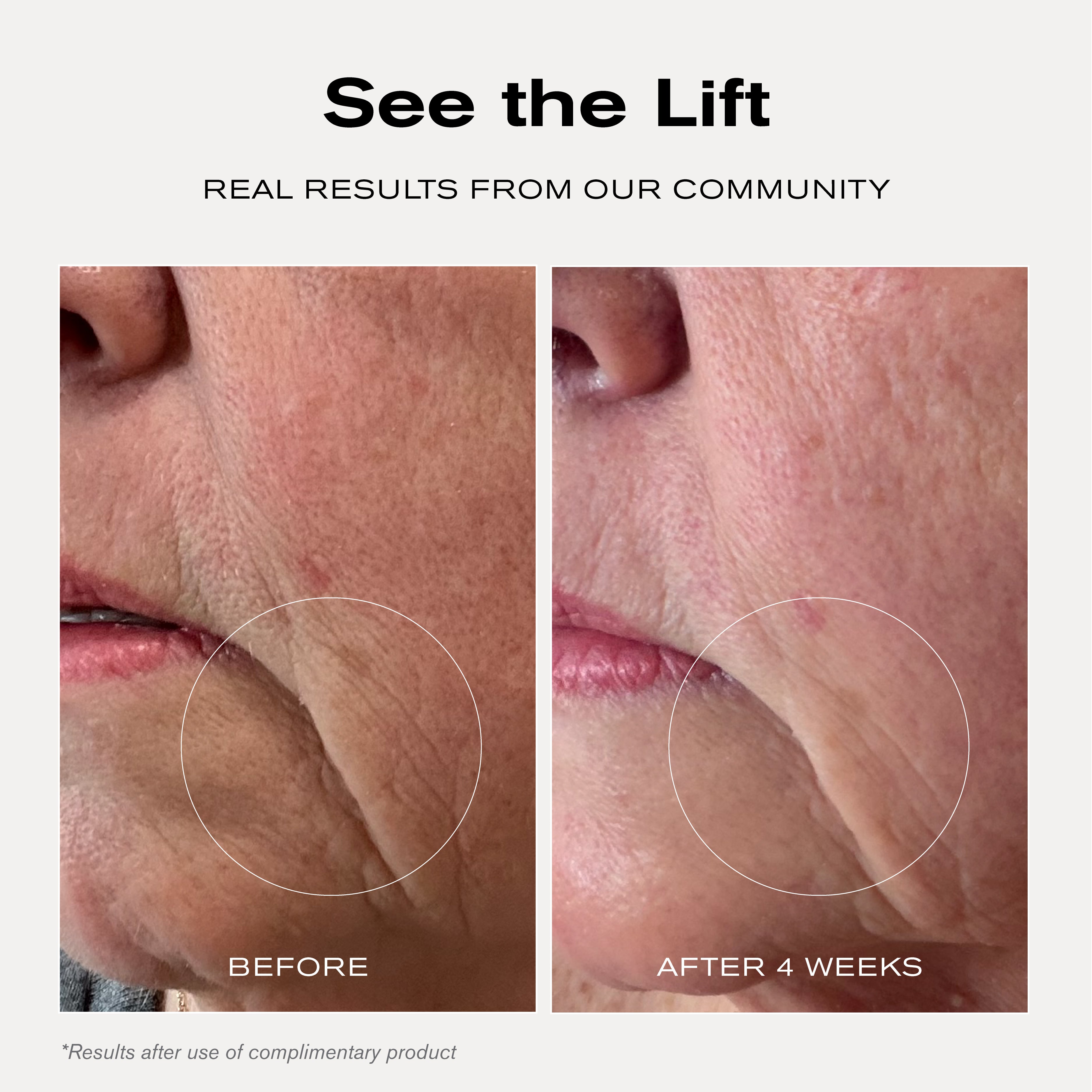 See the Lift
Real Results from Our Community
Before + After 4 Weeks
*Results after use of complimentary product.