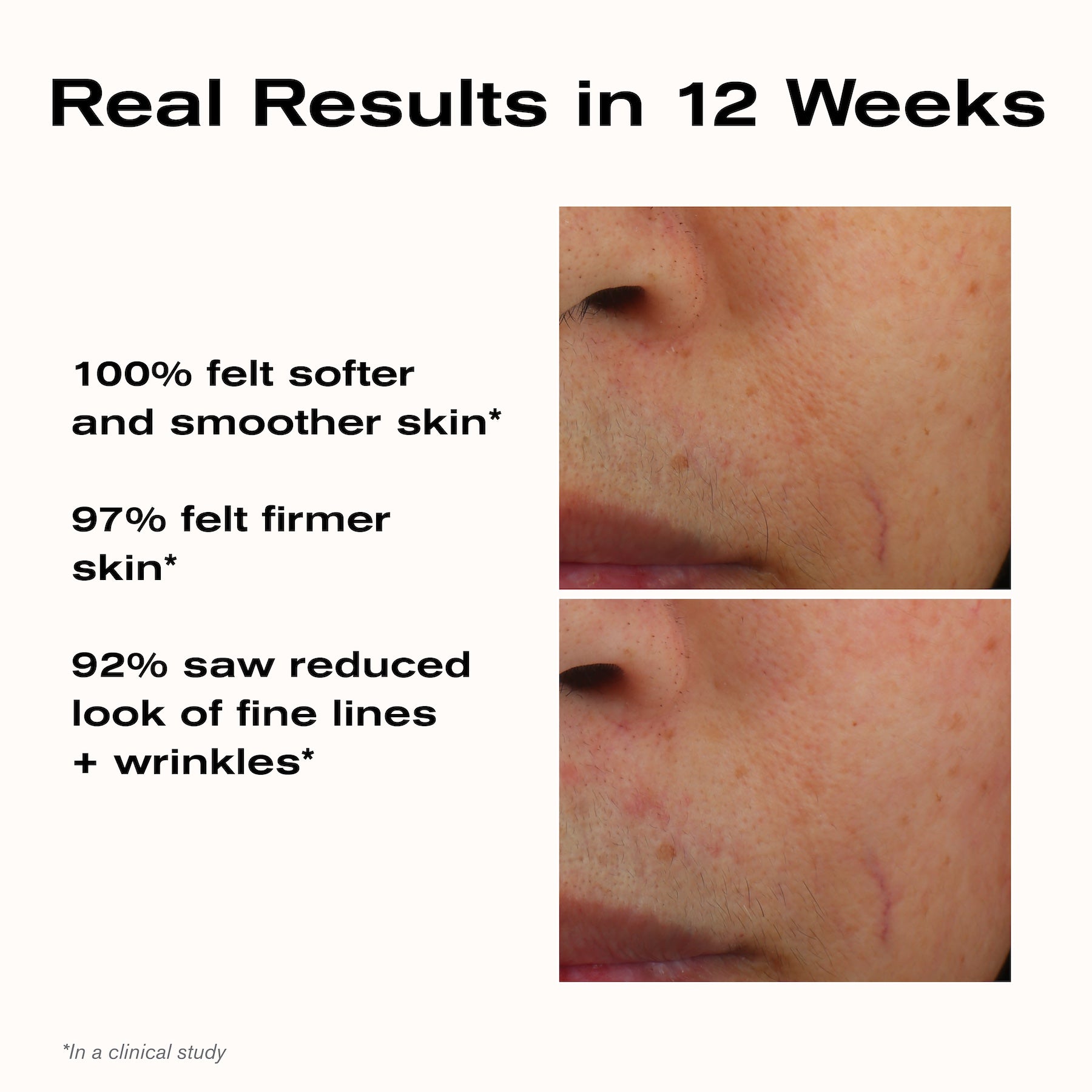 Real Results in 12 Weeks
100% felt softer and smoother skin*
97% felt firmer skin*
92% saw reduced look of fine lines + wrinkles*
*In a clinical study.