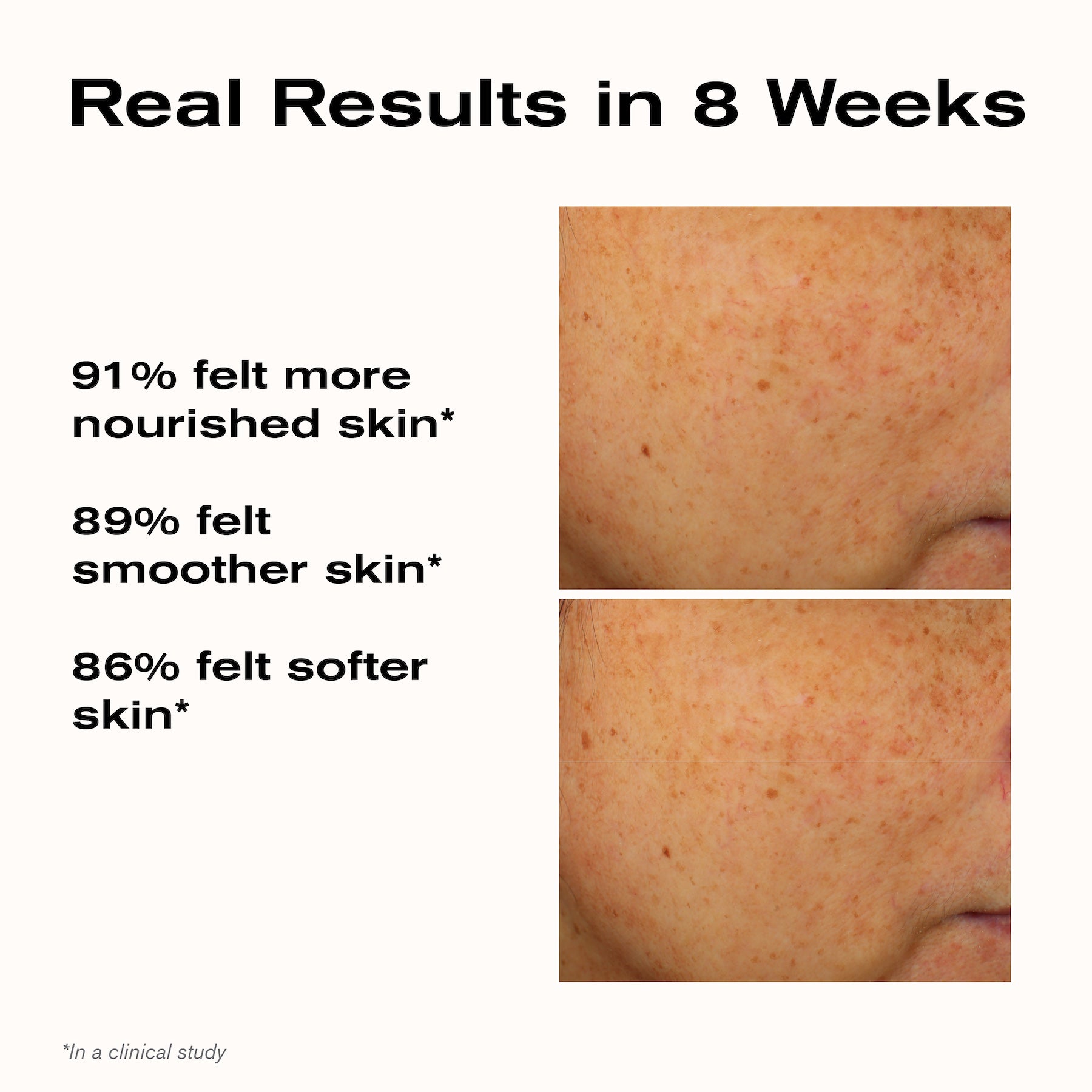 Real Results in 8 Weeks
91% felt more nourished skin*
89% felt smoother skin*
86% felt softer skin*
*In a clinical study.