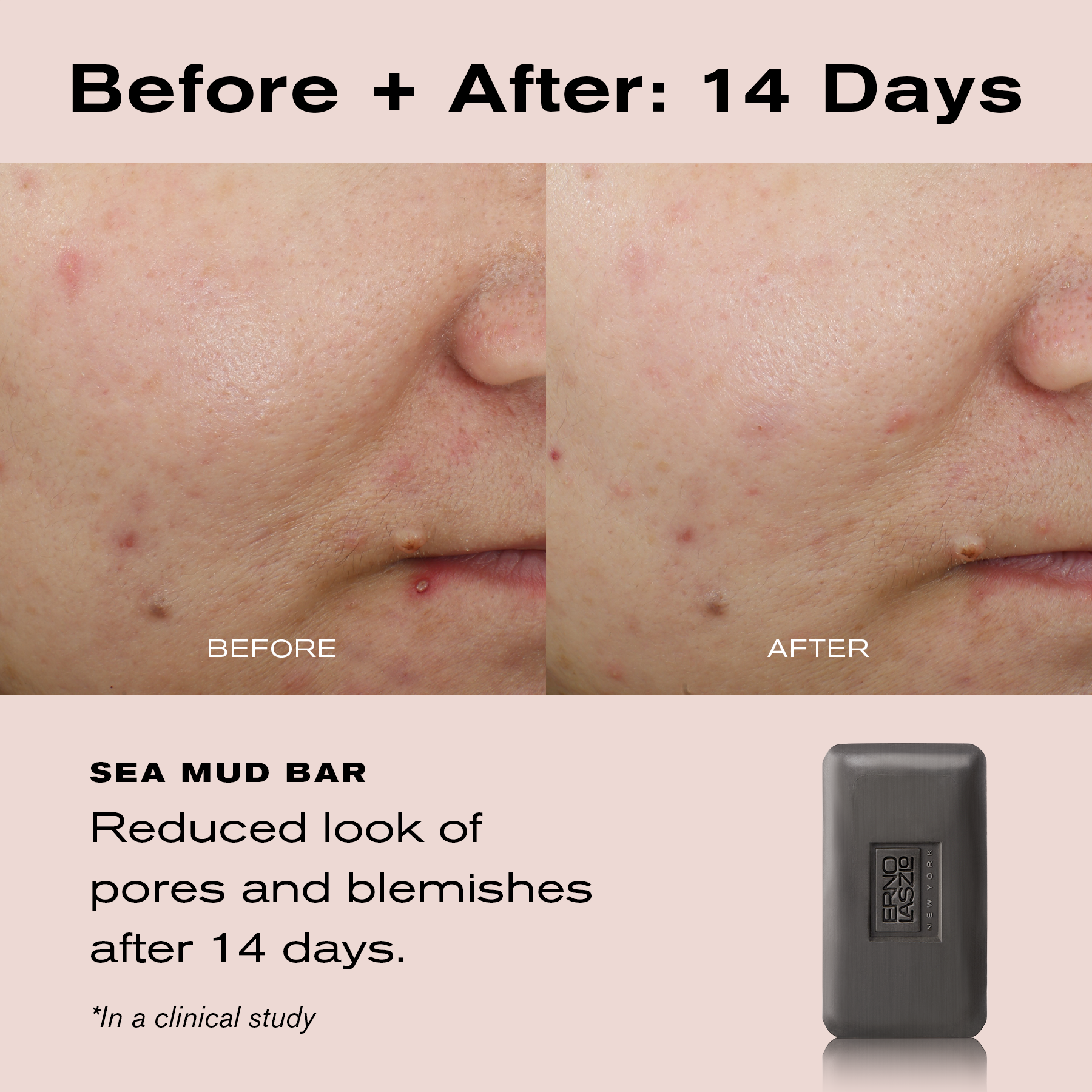 Before + After: 14 Days
Sea Mud Bar
Reduced look of pores and blemishes after 14 days.
*In a clinical study.