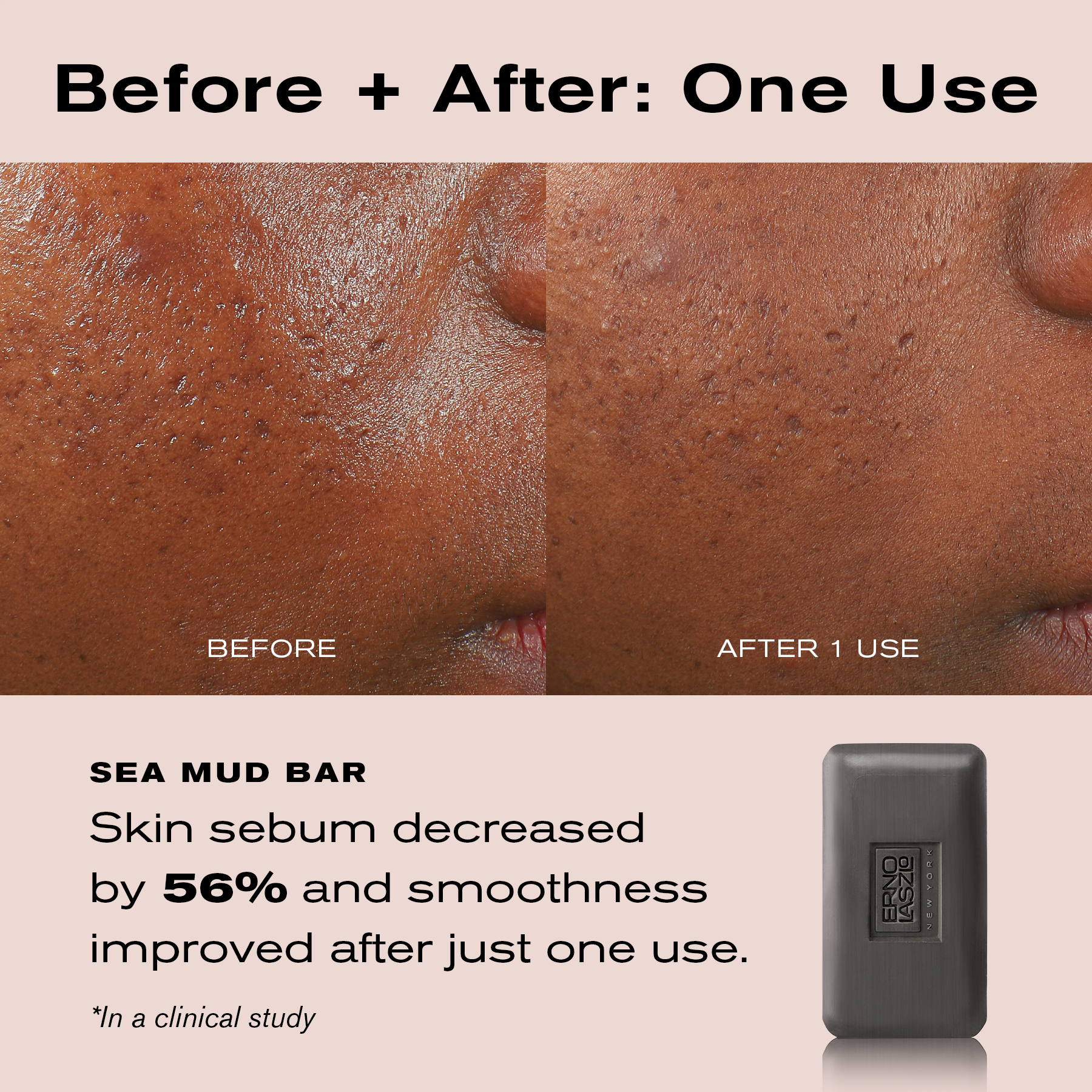 Before + After: One Use
Sea Mud Bar
Skin sebum decreased by 56% and smoothness improved after just one use.
*In a clinical study.