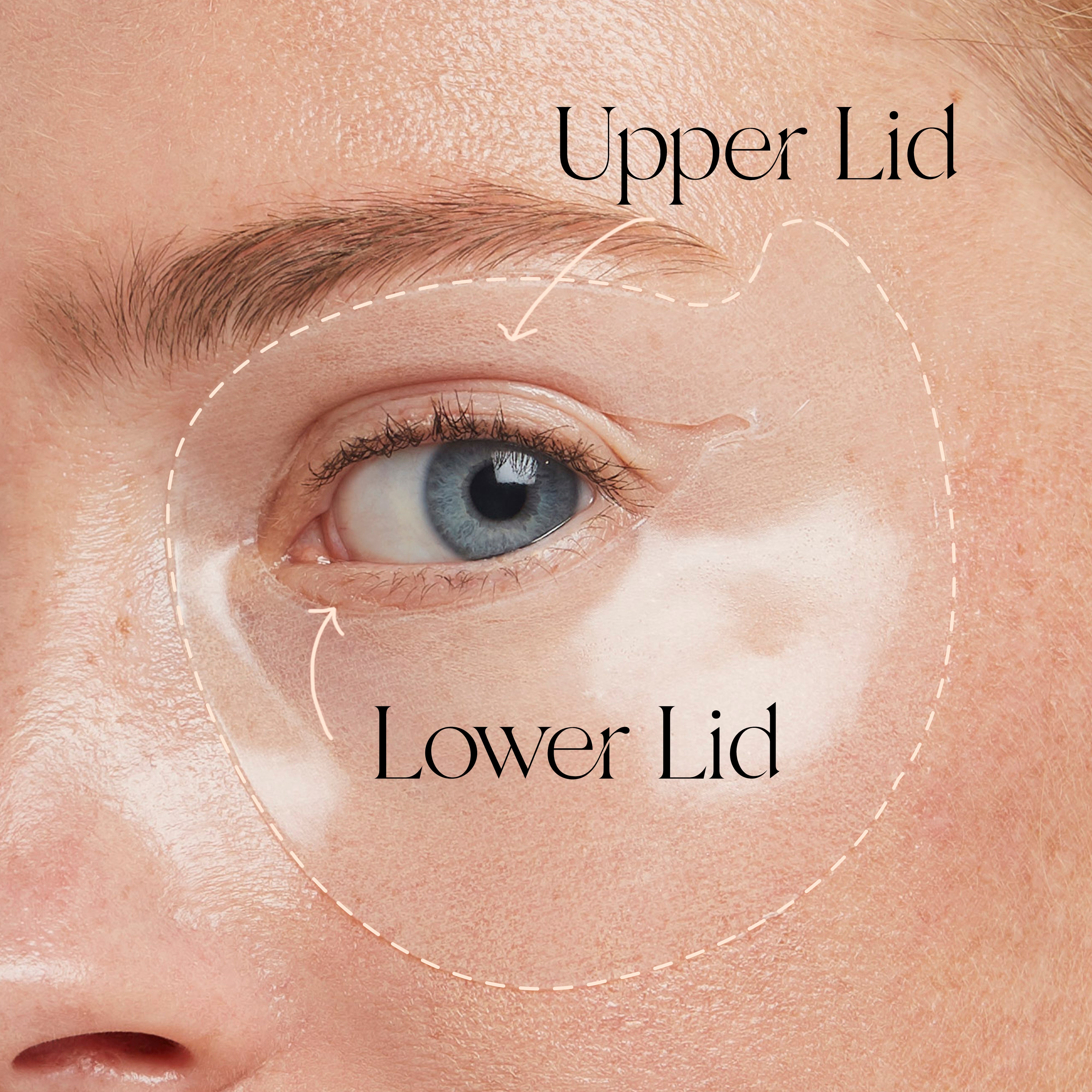 Upper Lid and Lower Lid Eye Masks