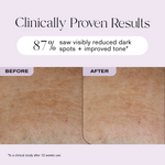 Clinically Proven Resuts
87% saw visibly reduced dark spots + improved tone*
*In a clinical study after 12 weeks of use.