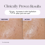 Clinically Proven Results
70% increase in skin hydration after just one use*
*In a clinical study.