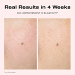 Real Results in 4 Weeks
46% Improvement in Elasticity*

*In a clinical study