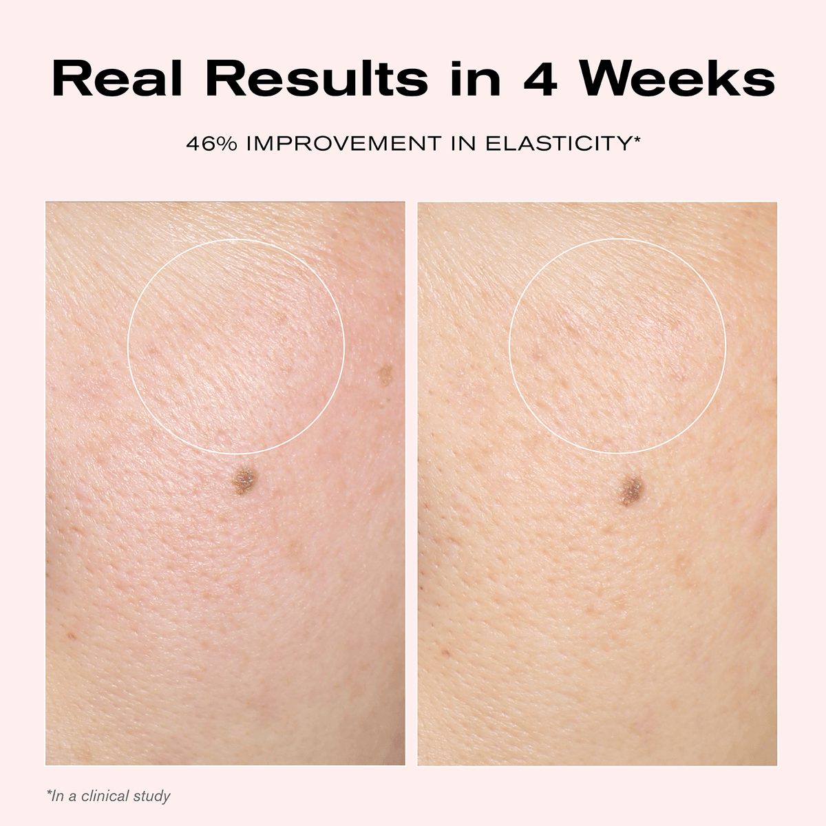 Real Results in 4 Weeks
46% Improvement in Elasticity*

*In a clinical study