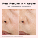 Real Results in 4 Weeks
191% Improvement in Skin Bounce*

*In a clinical study, based on dermal density instrumental measures.