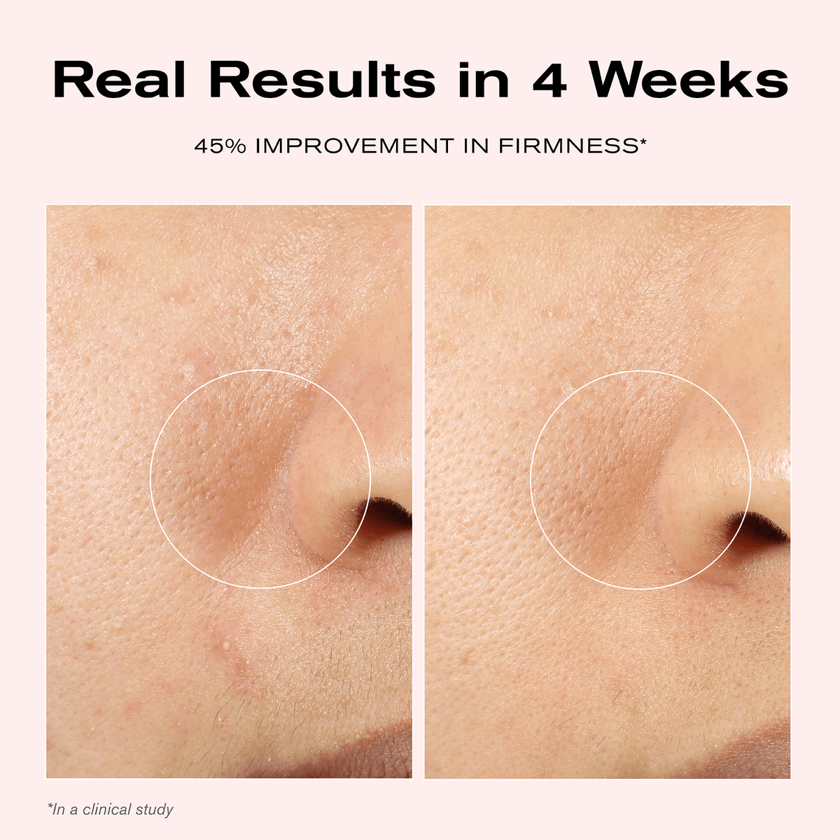 Real Results in 4 Weeks
45% Improvement in Firmness*

*In a clinical study