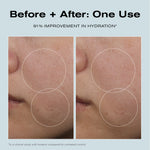 Before + After: One Use
91% Improvement in Hydration*

*In a clinical study with forearm compared to untreated control.