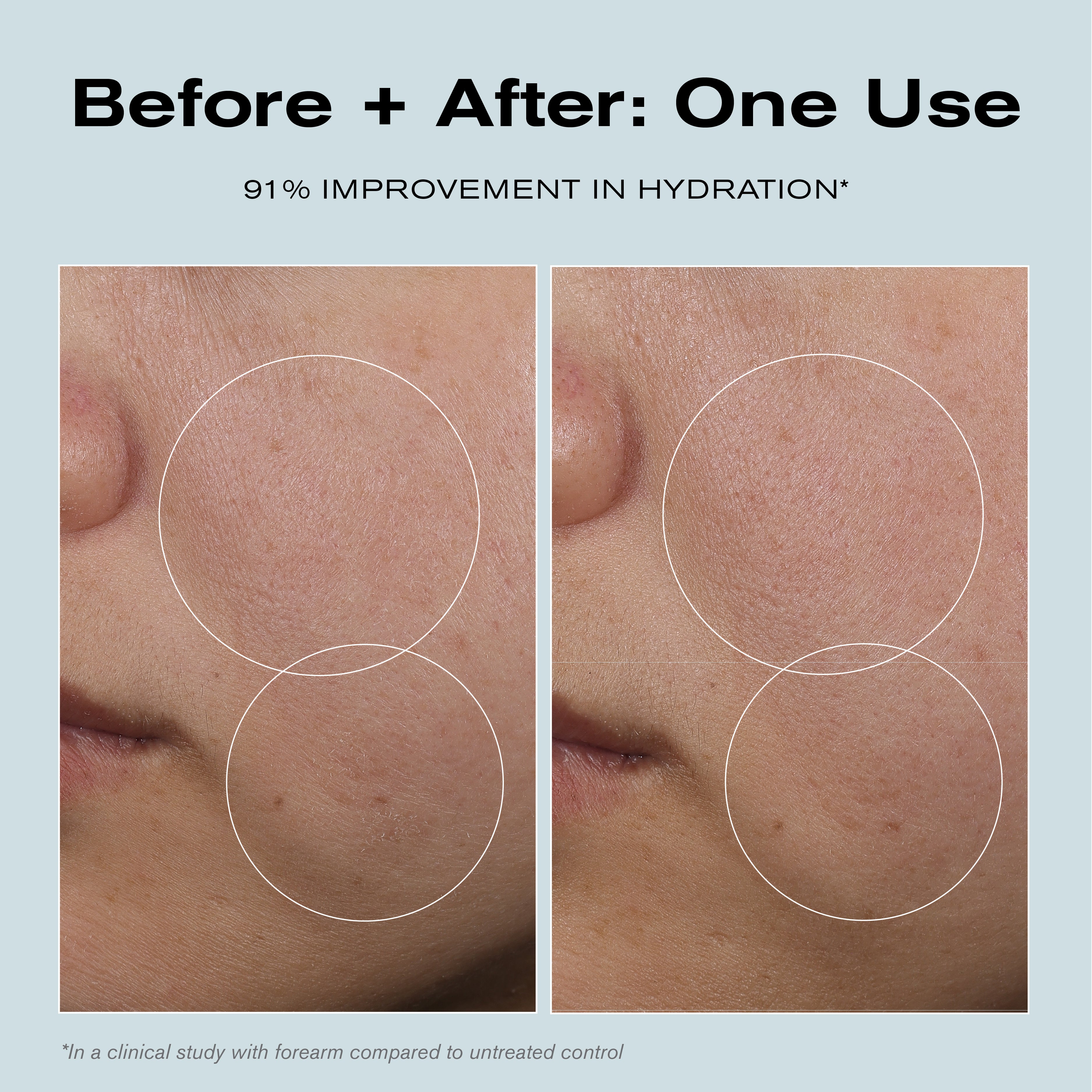 Before + After: One Use
91% Improvement in Hydration*

*In a clinical study with forearm compared to untreated control.