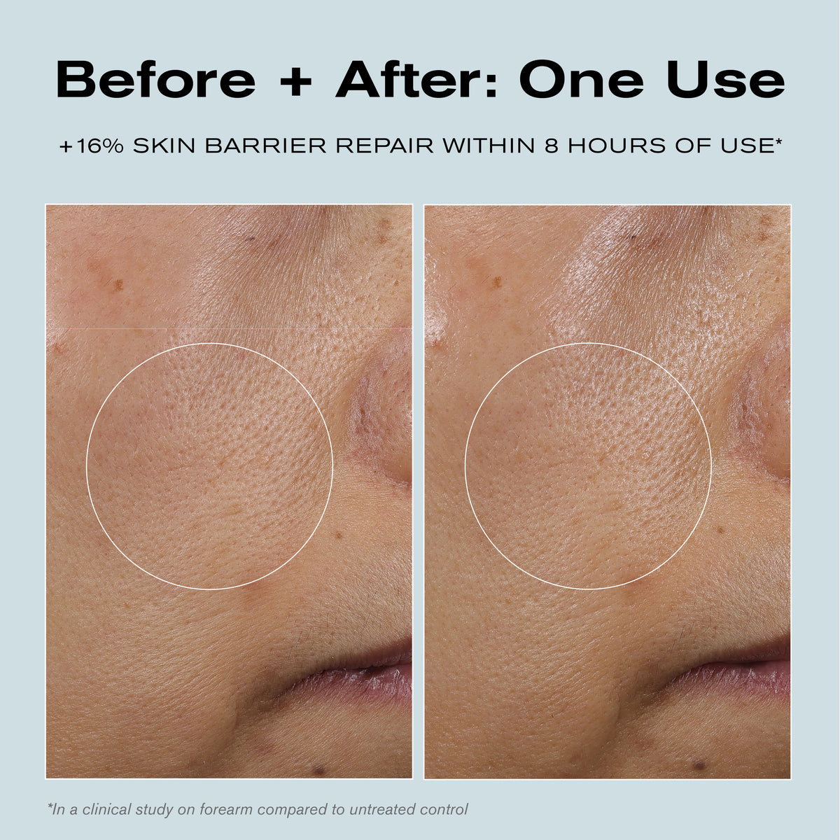 Before + After: One Use
+16% Skin Barrier Repair within 8 hours of use*

*In a clinical study on forearm compared to untreated control.