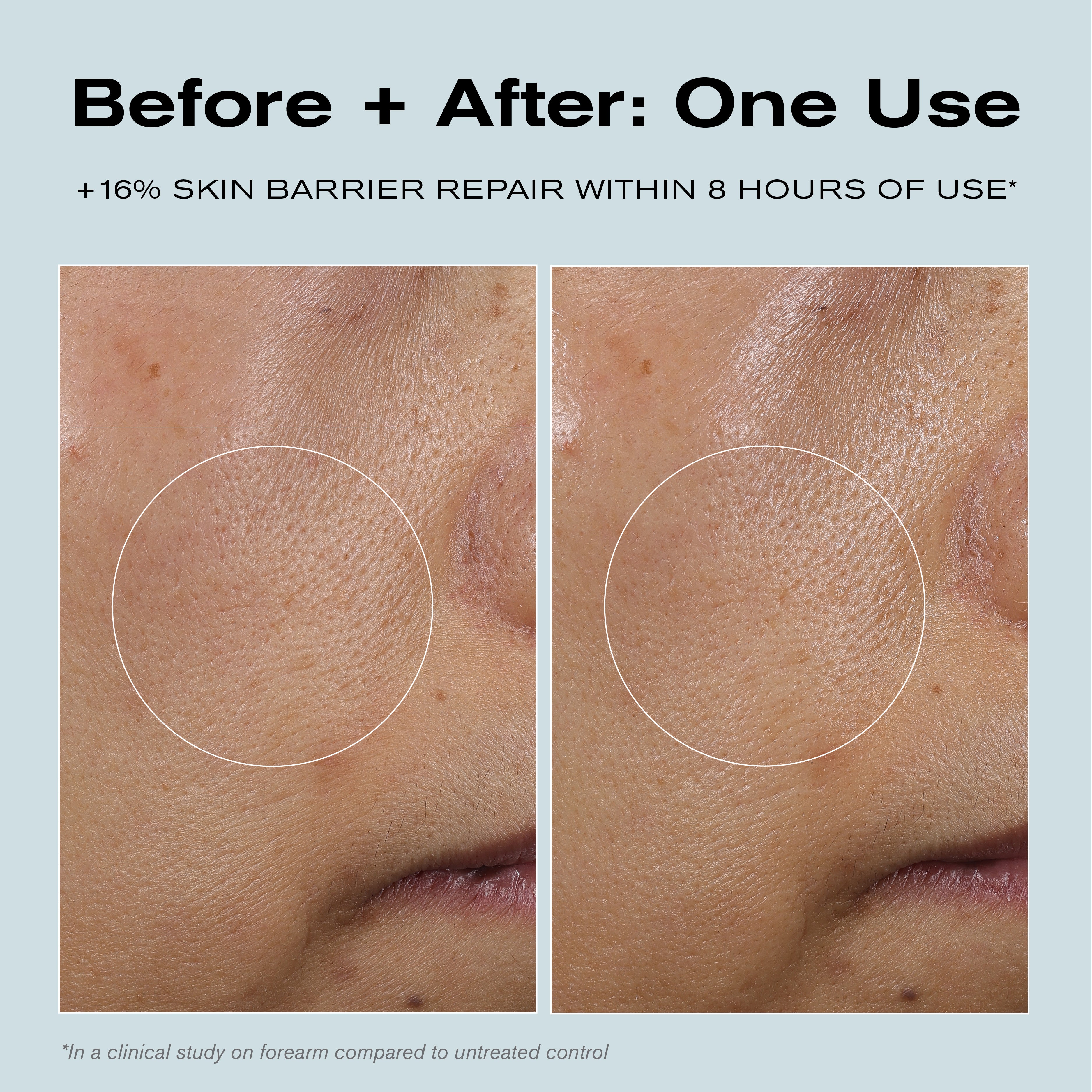 Before + After: One Use
+16% Skin Barrier Repair within 8 hours of use*

*In a clinical study on forearm compared to untreated control.