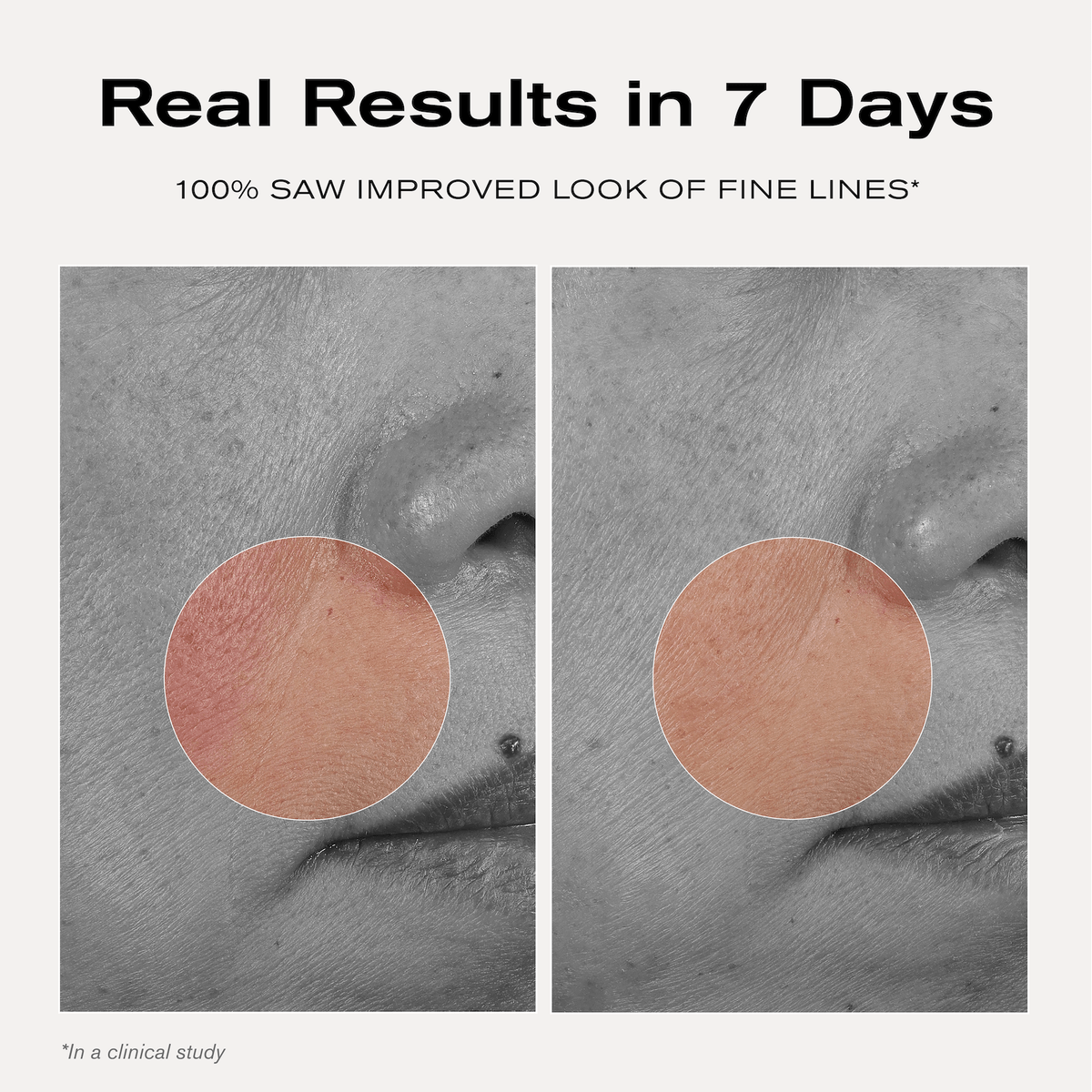 Real Results in 7 Days
100% saw improved look of fine lines*

*in a clinical study