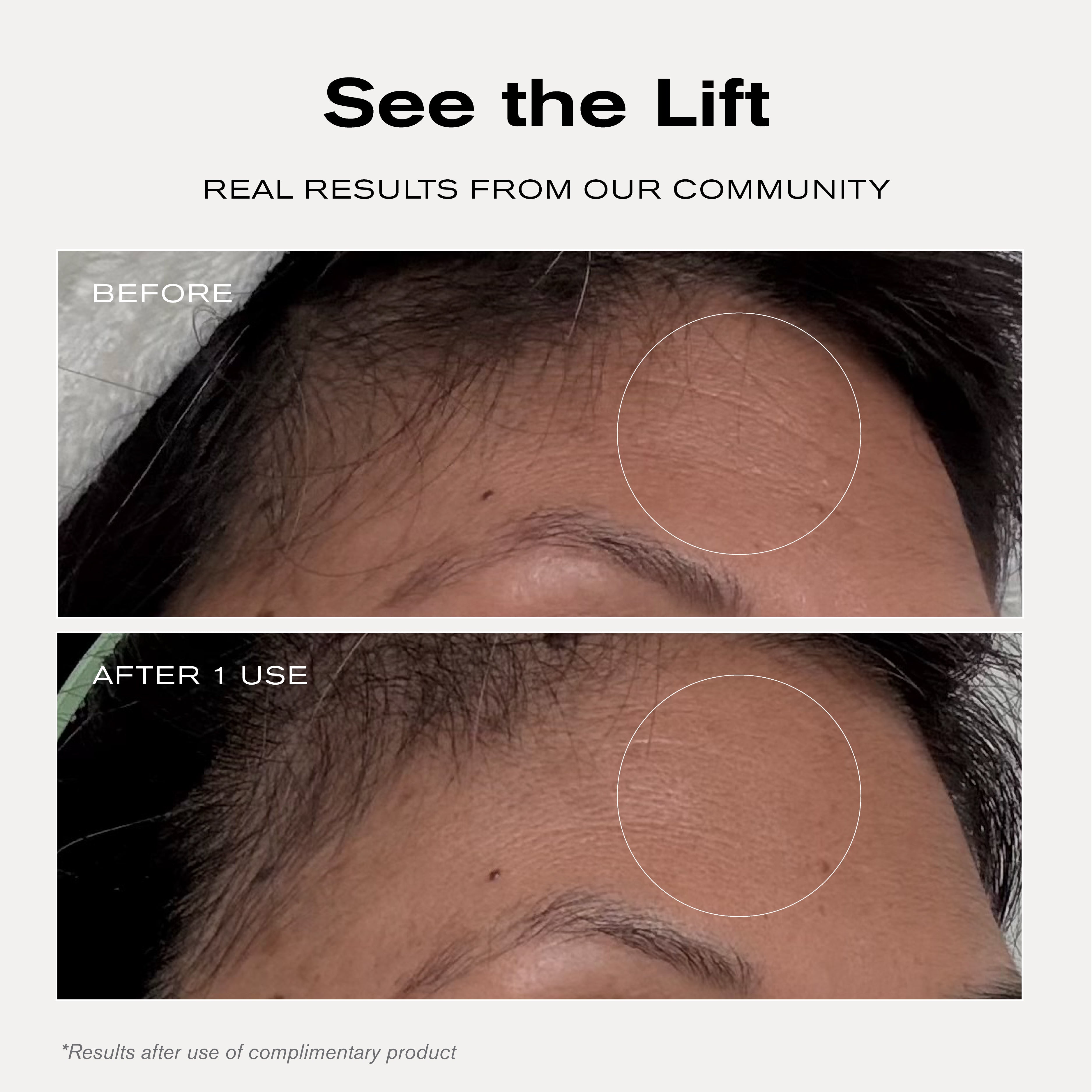 See the Lift
Real Results from Our Community
Before + After 1 Use

*Results after use of complimentary product.