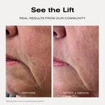 See the Lift
Real Results from Our Community
Before + After 4 Weeks

*Results after use of complimentary product.