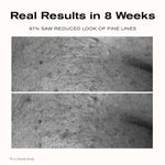 Real Results in 8 weeks
97% saw reduced look of fine lines