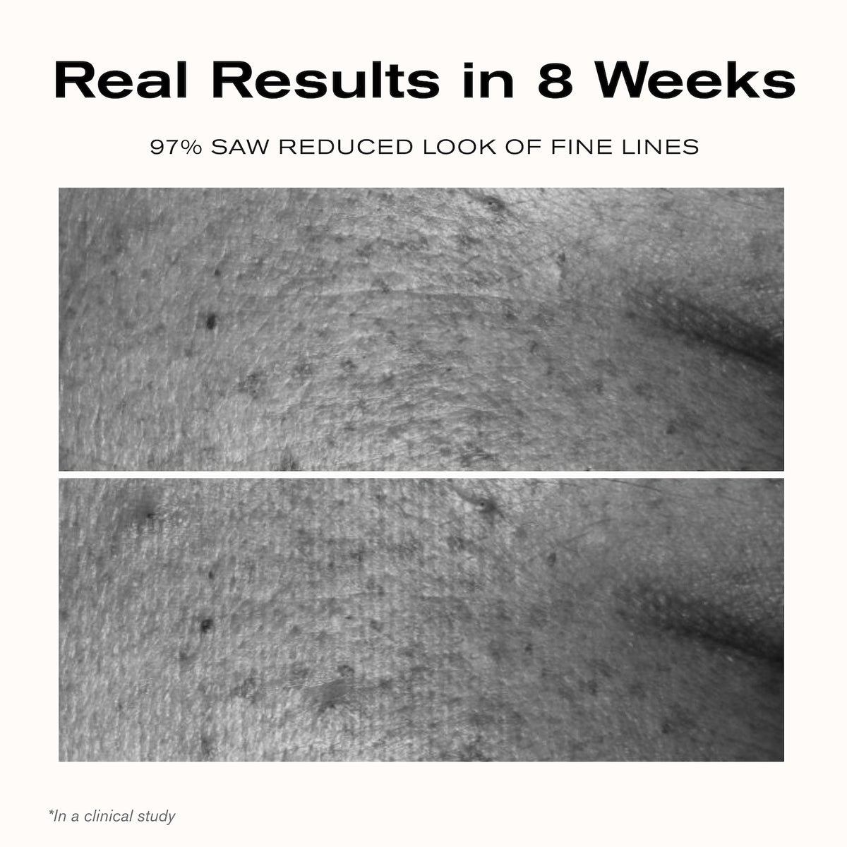 Real Results in 8 weeks
97% saw reduced look of fine lines