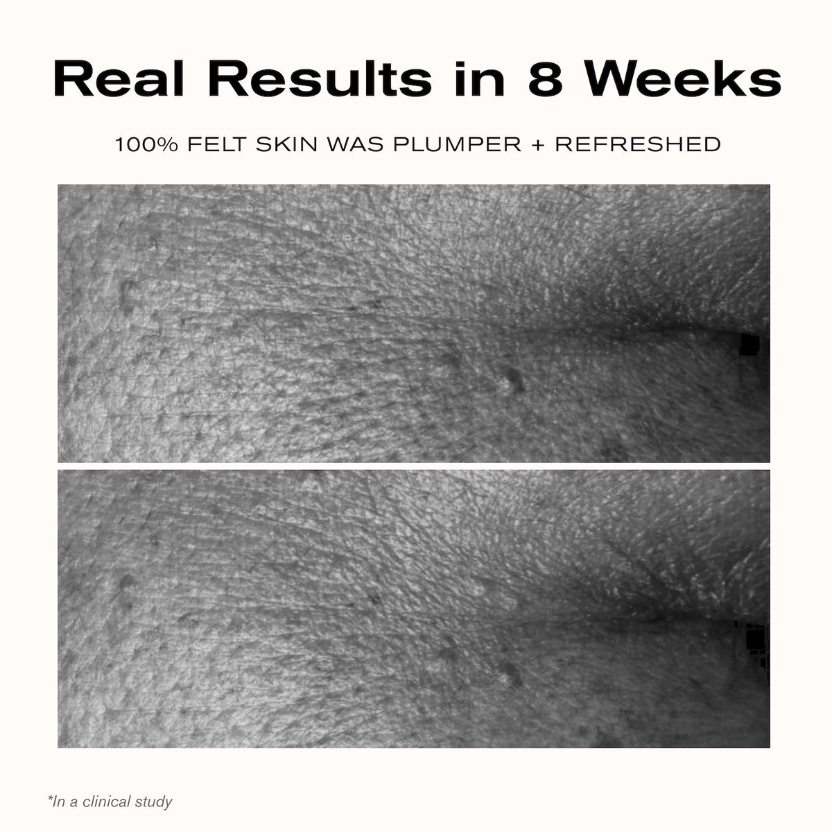 Real Results in 8 Weeks
100% felt skin was plumper + refreshed