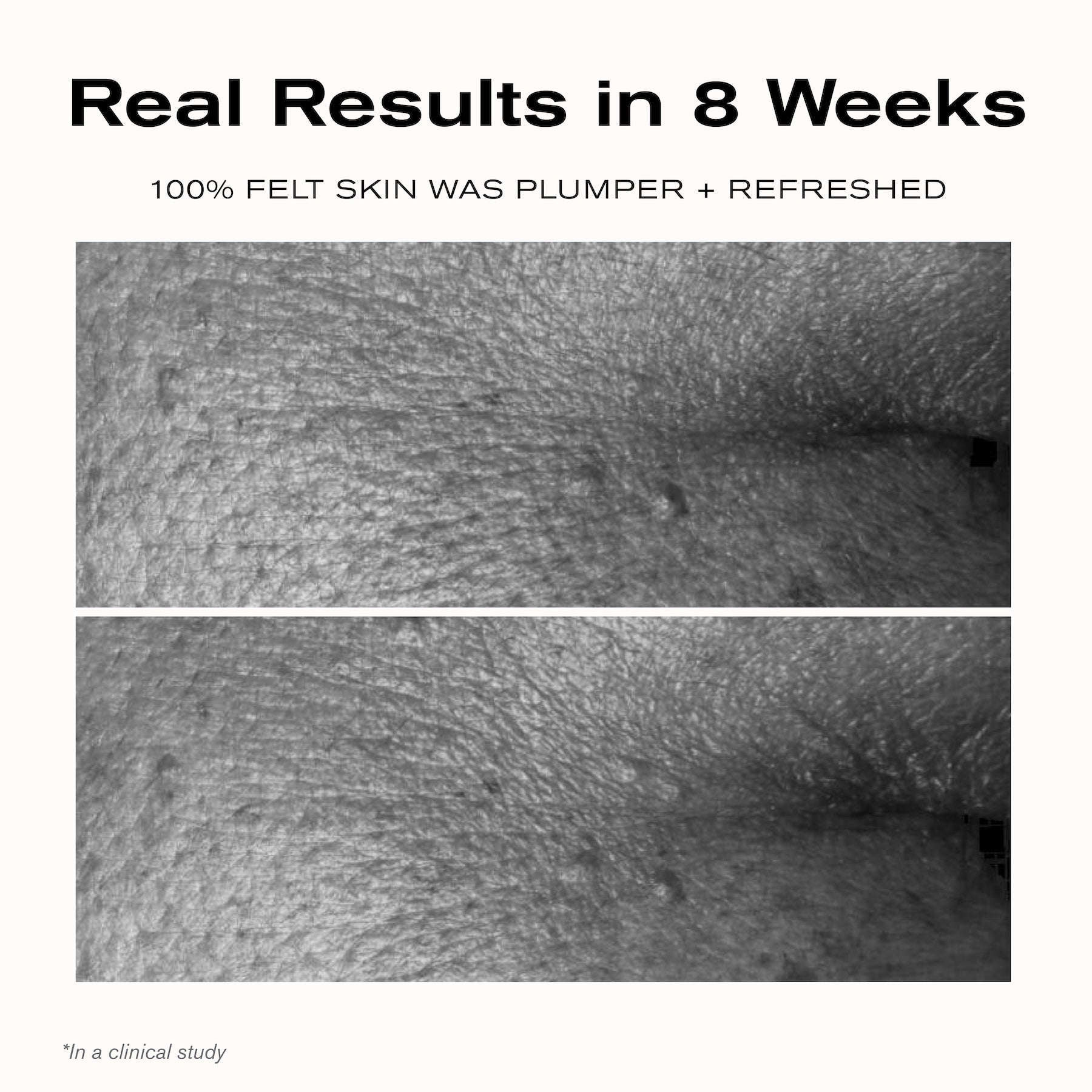 Real Results in 8 Weeks
100% felt skin was plumper + refreshed