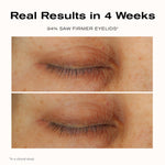 Real Results in 4 Weeks
94% saw firmer eyelids*

*In a clinical study.
