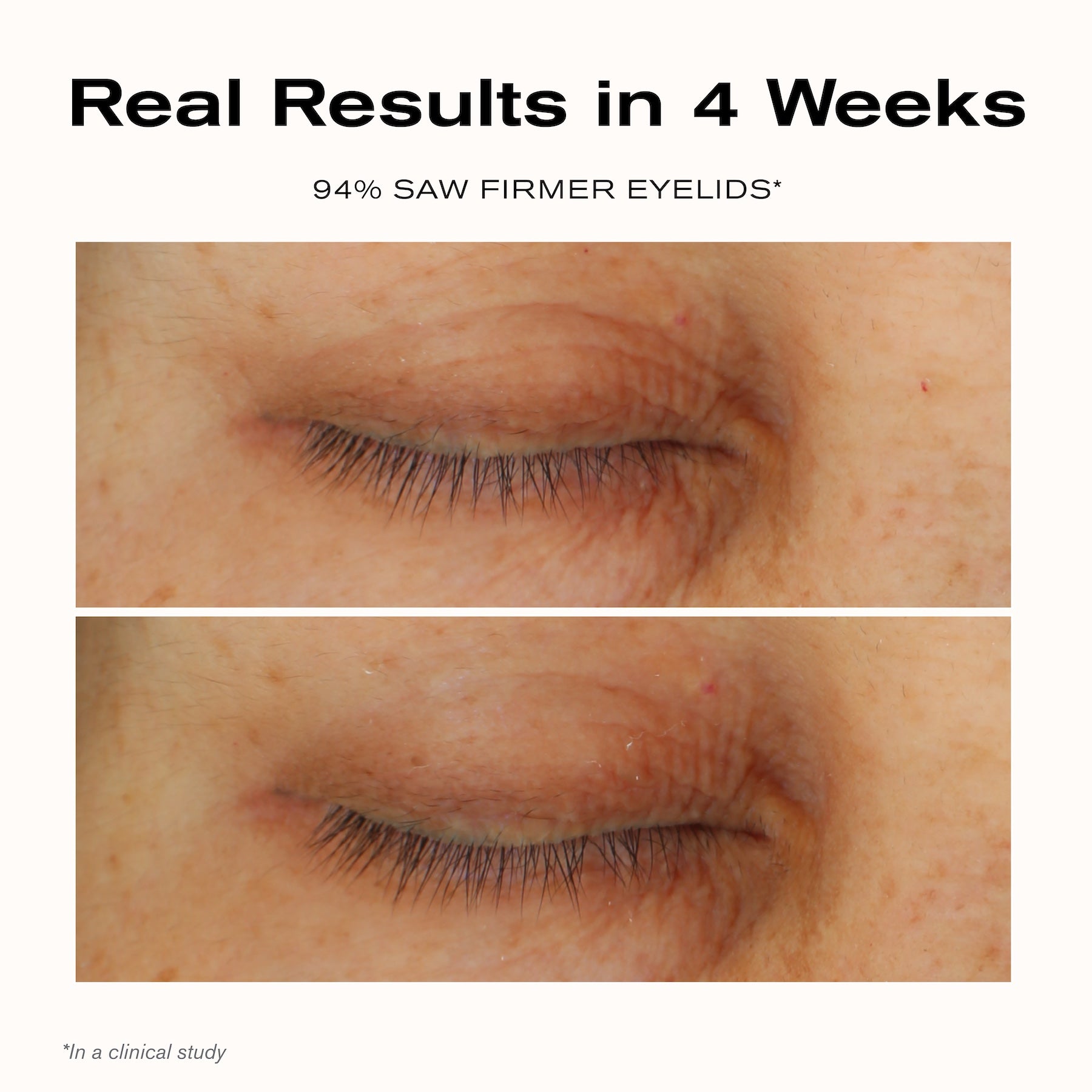 Real Results in 4 Weeks
94% saw firmer eyelids*

*In a clinical study.