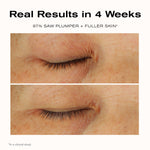 Real Results in 4 Weeks
97% saw plumper + fuller skin*

*In a clinical study.