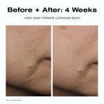 Before + After: 4 Weeks
100% saw firmer looking skin*
*In a clinical study