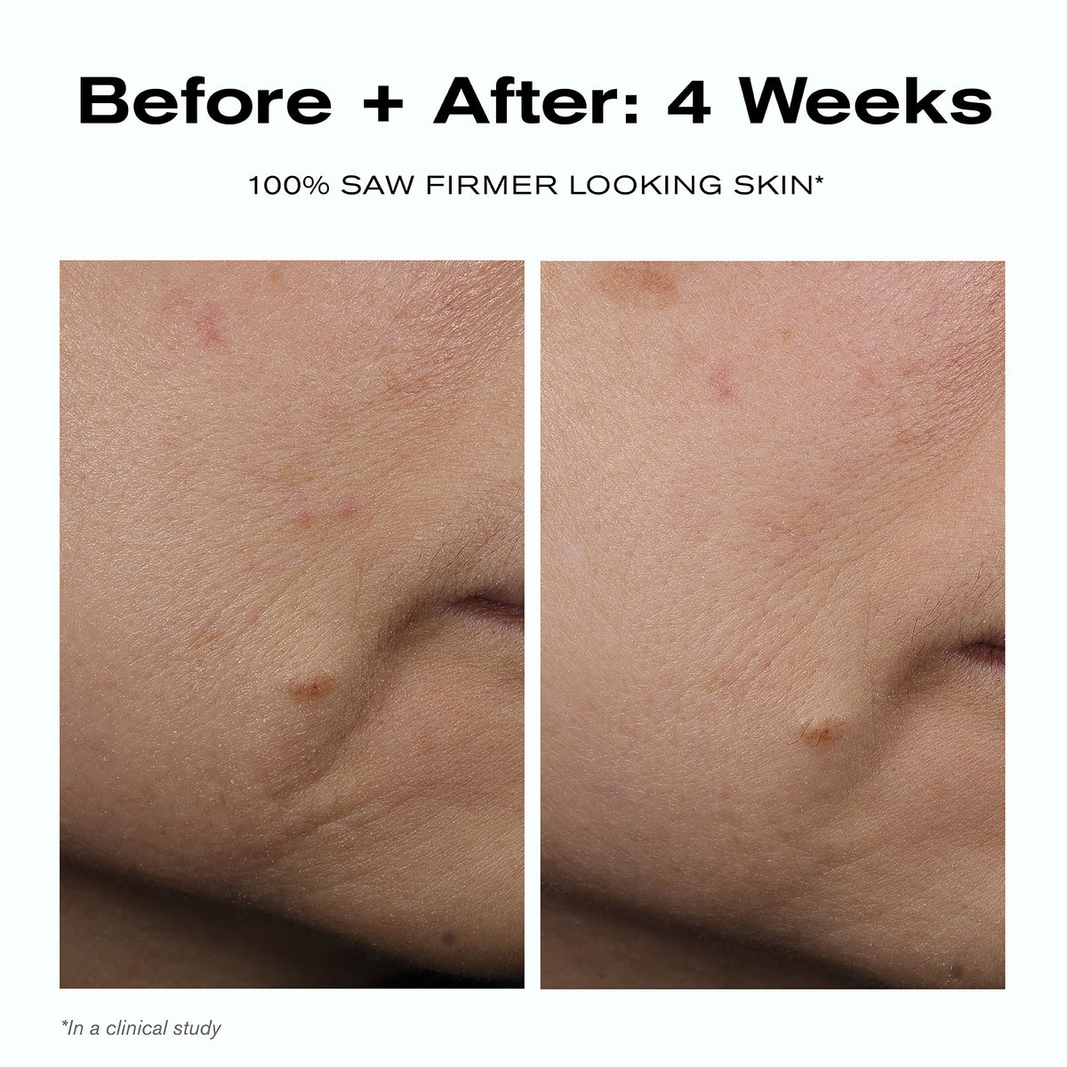 Before + After: 4 Weeks
100% saw firmer looking skin*
*In a clinical study