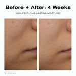 Before + After: 4 Weeks
100% felt long-lasting moisture*
*In a clinical study.