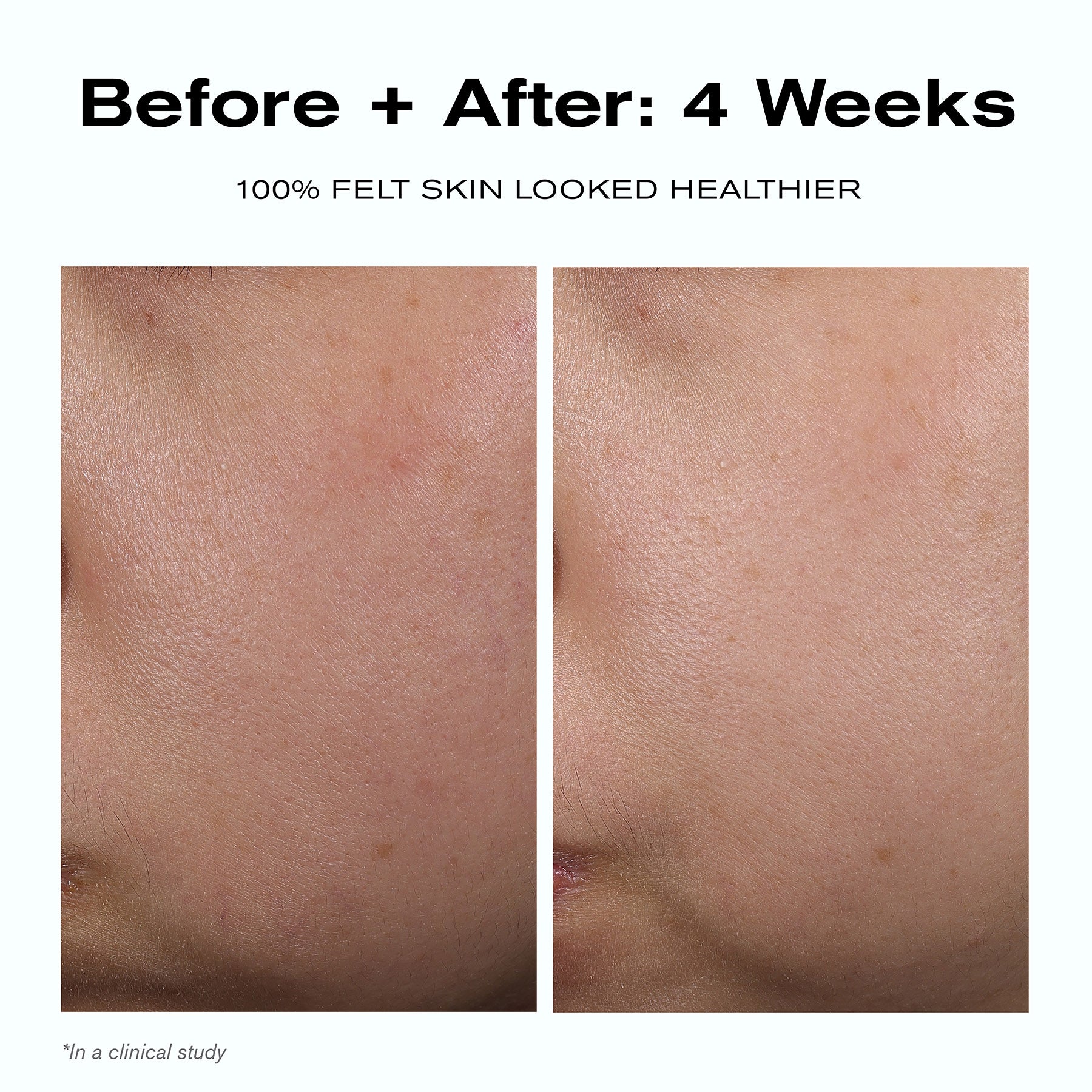 Skin Barrier Duo | Skincare Sets | Erno Laszlo