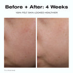 Before + After: 4 Weeks
100% felt skin looked healthier*
*In a clinical study