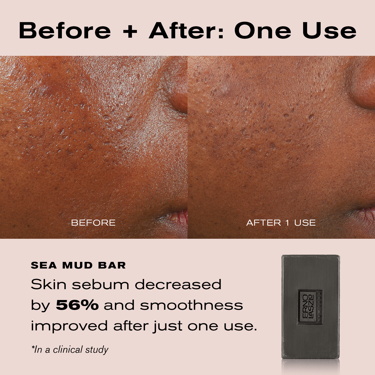Before + After: One Use
Sea Mud Bar
Skin sebum decreased by 56% and smoothness improved after just one use. 
*In a clinical study.