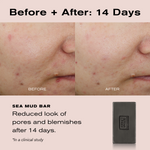 Before + After: 14 Days
Sea Mud Bar reduced look of blemishes after 14 days. 

*In a clinical study