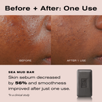 Before + After: One Use
Sea Mud Bar
Skin sebum decreased by 56% and smoothness improved after just one use.
*In a clinical study.