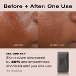 Before and after comparison of skin texture on a person's cheek, with text stating 'Before + After: One Use' and 'SEA MUD BAR' plus a small dark gray soap bar shown on the right.