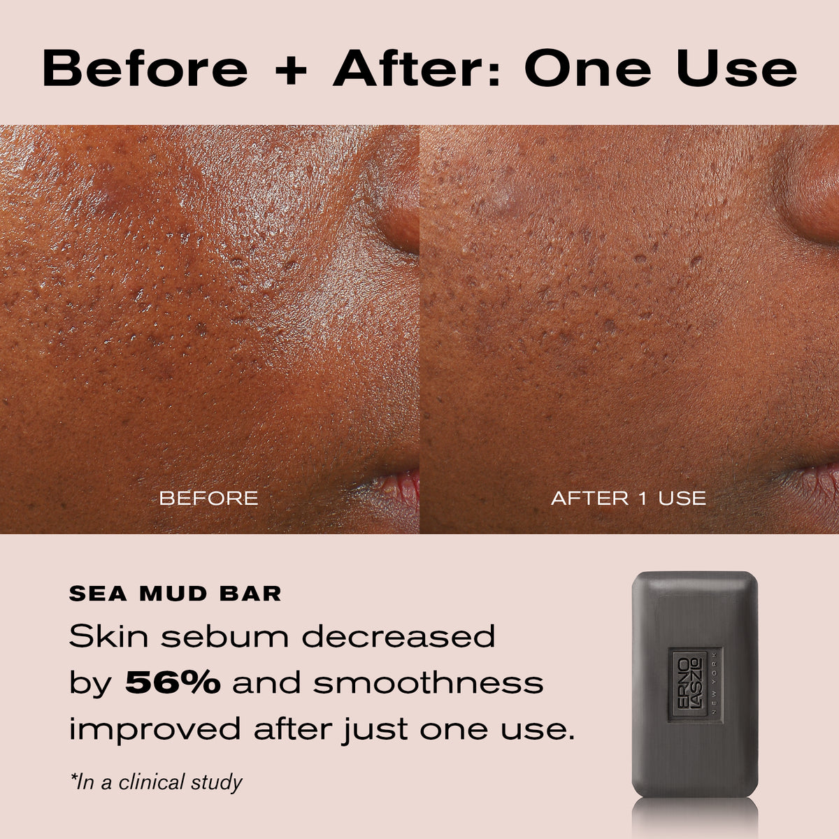 Before and after comparison of skin texture on a person's cheek, with text stating 'Before + After: One Use' and 'SEA MUD BAR' plus a small dark gray soap bar shown on the right.