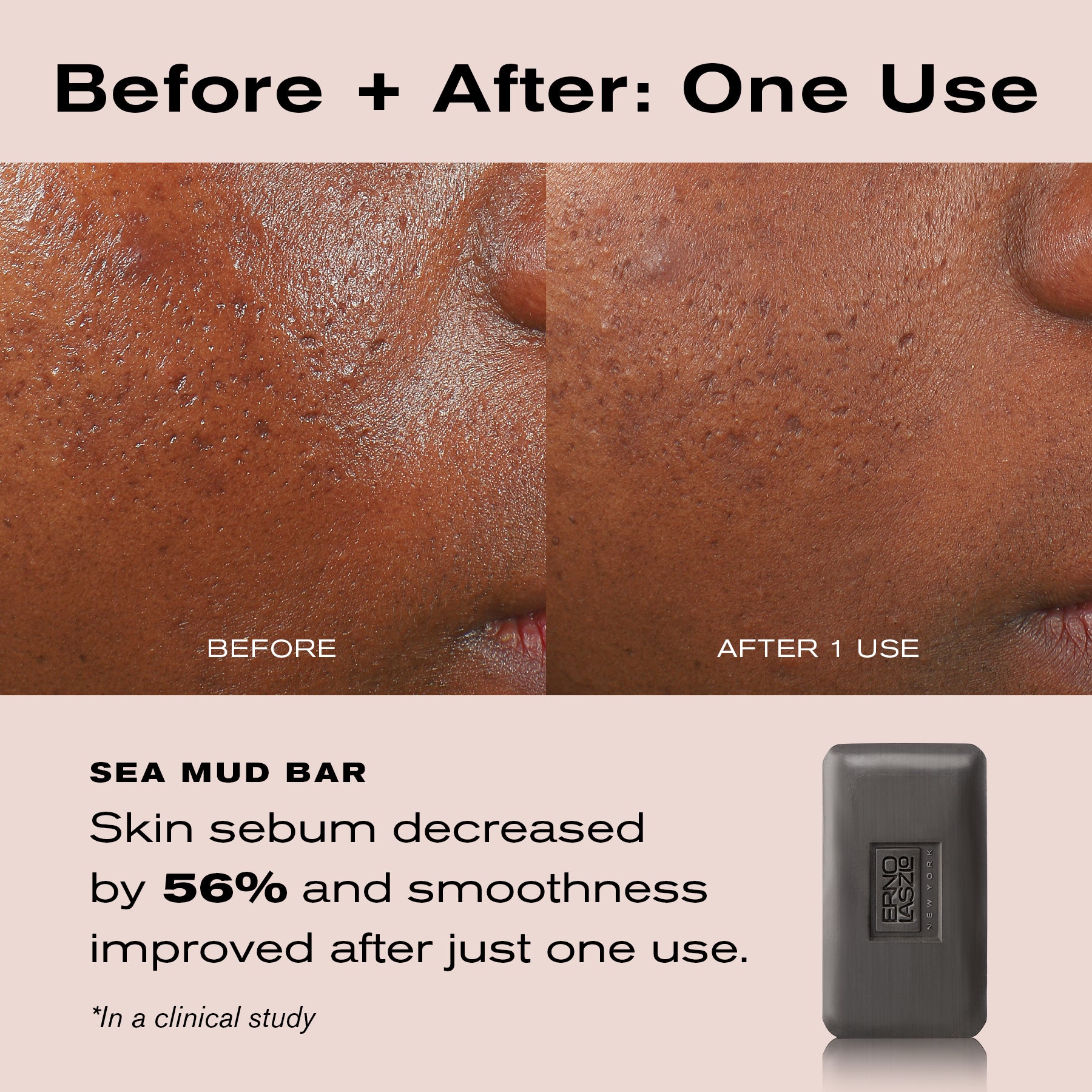 Before and after comparison of skin texture on a person's cheek, with text stating 'Before + After: One Use' and 'SEA MUD BAR' plus a small dark gray soap bar shown on the right.
