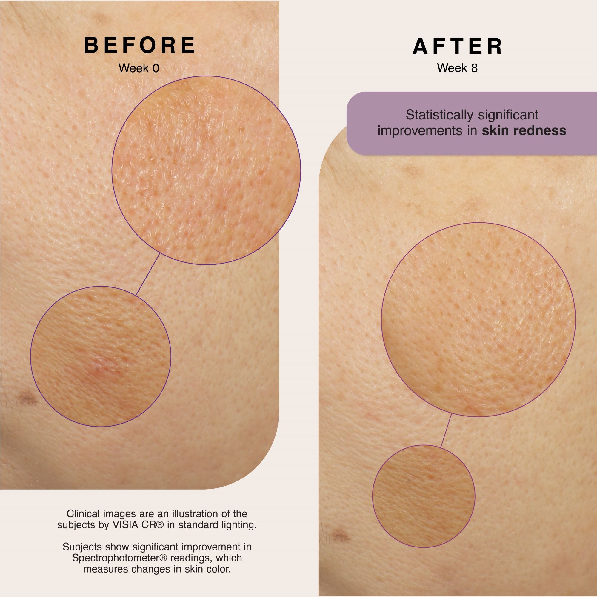 Soothing Relief Hydration Emulsion